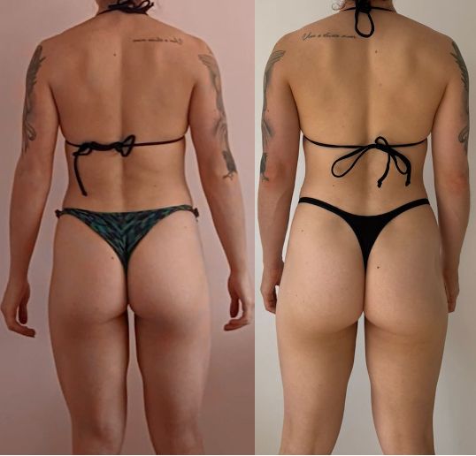 Antes e depois de aluna — vista posterior