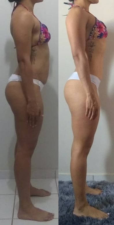 Antes e depois de aluna — vista lateral
